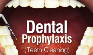 teeth-cleaning