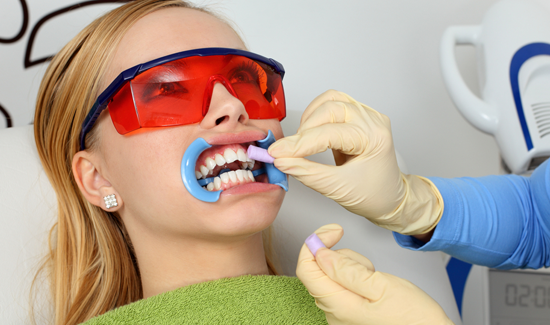 teeth_whitening