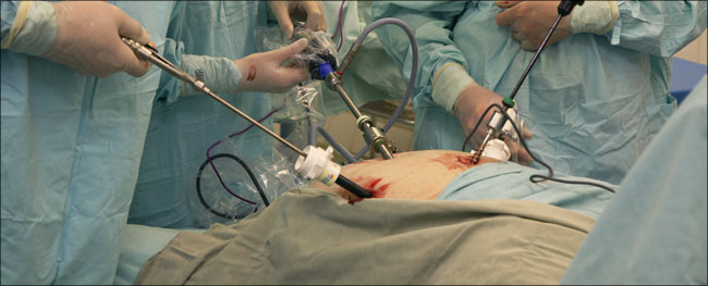 Image result for The ABC of Gastric Bypass Surgery