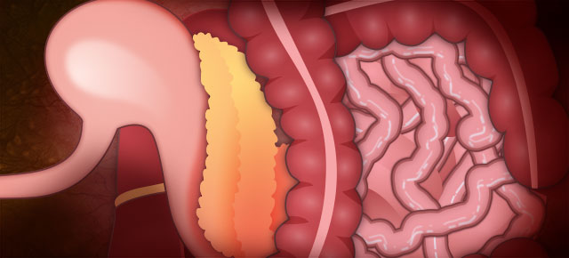 Laparoscopic Gastric Bypass