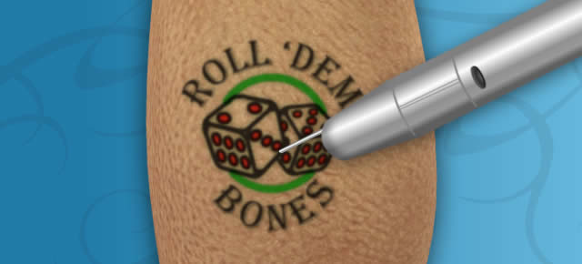 Laser Tattoo Removal