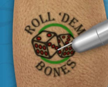 Surgery Squad Laser Tattoo Removal